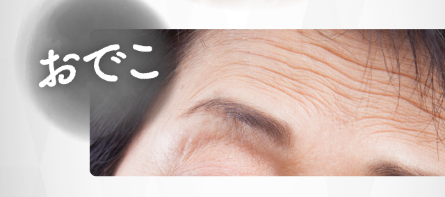 おでこ