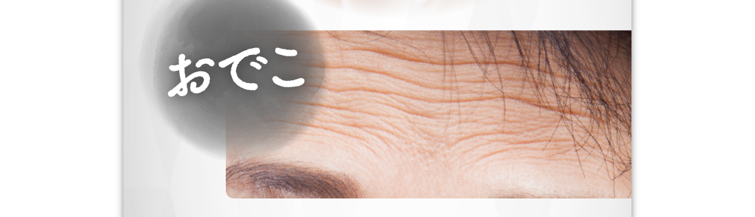 おでこ