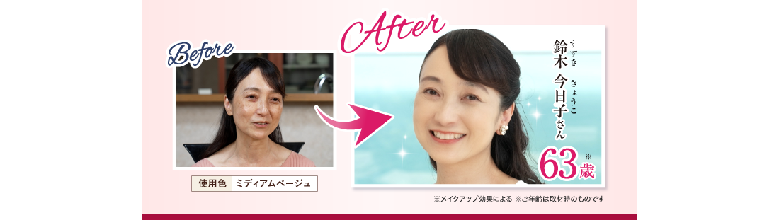 Before After 鈴木 今日子さん63歳