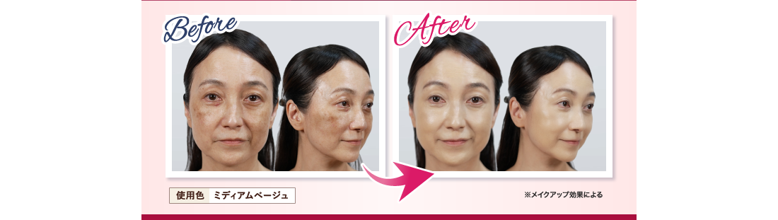 Before After 鈴木 今日子さん63歳